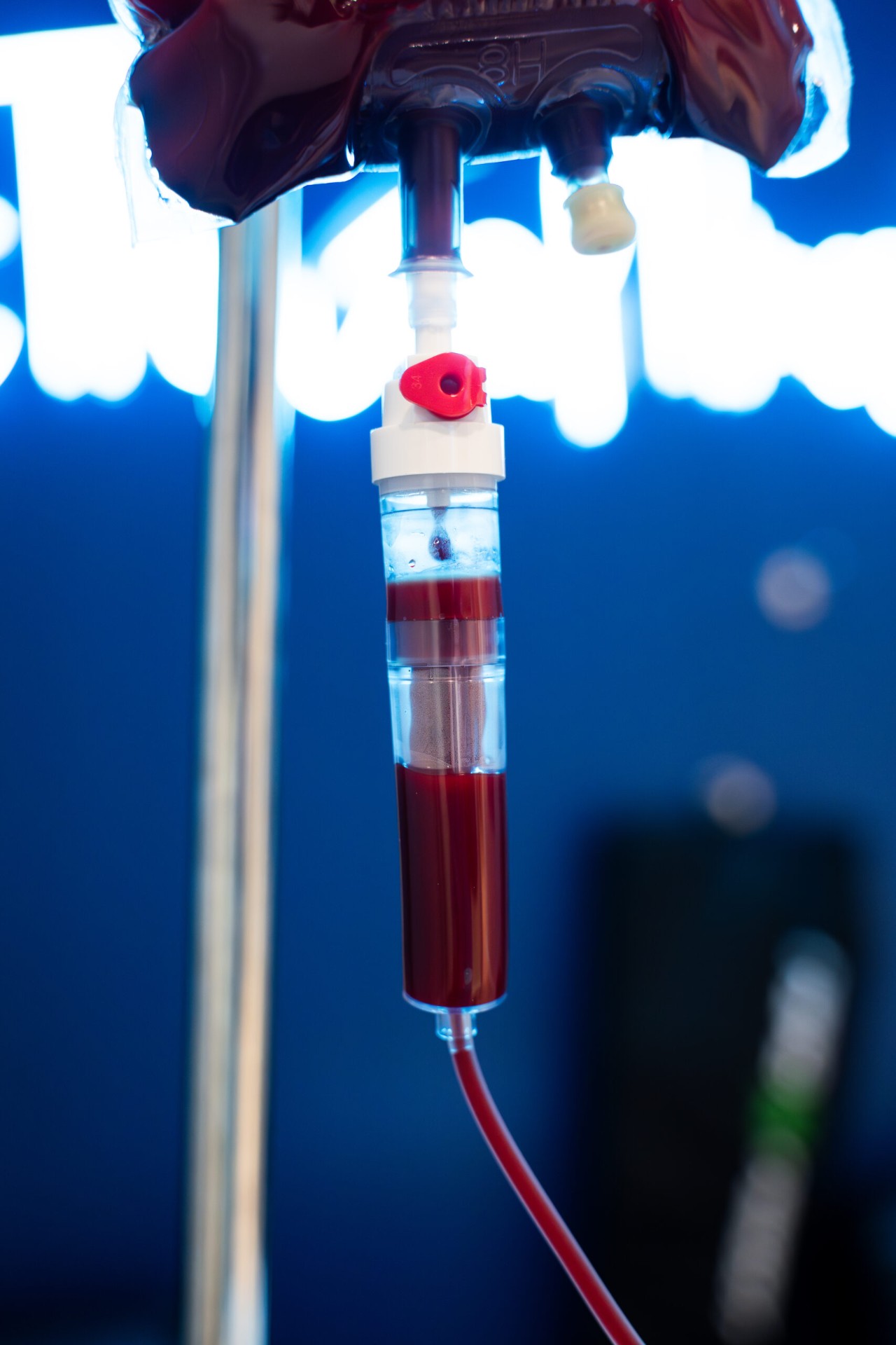 Medical-grade ozone IV bag prepared for precision delivery at iCRYO Boca Raton